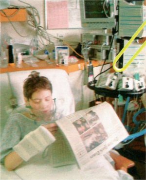 Laura Rothenberg after one of her many surgeries.