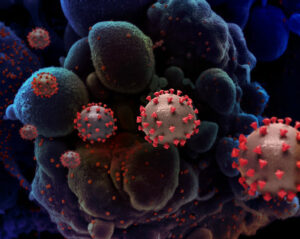 Creative rendition of SARS-CoV-2 virus particles. Photo: National Institute of Allergy & Infectious Diseases